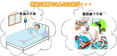 術後2週間でこんなに差が