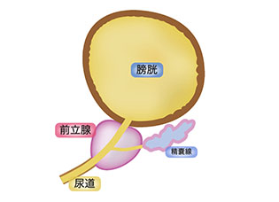 前立腺肥大症とは